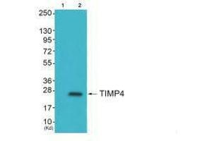 TIMP4抗体（C-Term）