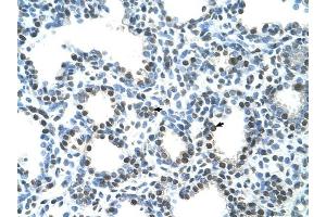 Semenogelin I antibody was used for immunohistochemistry at a concentration of 4-8 ug/ml to stain Alveolar ceils (arrows) in Human Lung. (SEMG1 antibody  (N-Term))