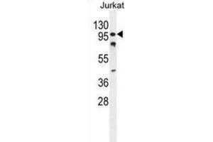 Western Blotting (WB) image for anti-CWC22 Spliceosome-Associated Protein Homolog (CWC22) antibody (ABIN2995841) (CWC22 antibody)