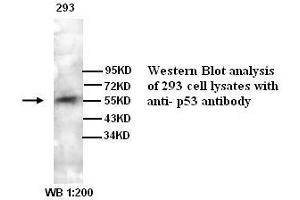 Image no. 1 for anti-Tumor Protein P53 (TP53) antibody (ABIN790965) (p53 antibody)