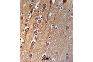 CI091 Antibody (C-term) IHC analysis in formalin fixed and paraffin embedded brain tissue followed by peroxidase conjugation of the secondary antibody and DAB staining. (C9ORF91 antibody  (C-Term))