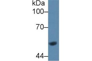 Western blot analysis of Rat Liver lysate, using Rat GCK Antibody (1 µg/ml) and HRP-conjugated Goat Anti-Rabbit antibody ( (GCK antibody  (AA 194-410))