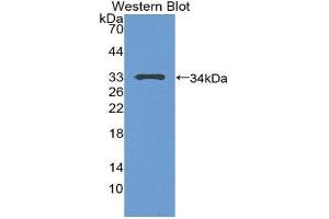 Western Blotting (WB) image for anti-Tumor Protein P53 (TP53) (AA 108-370) antibody (ABIN1078633) (p53 antibody  (AA 108-370))