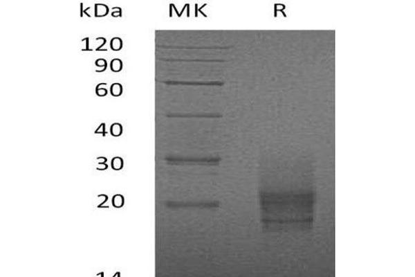 GM-CSF Protein (His tag)