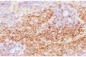 Immunohistochemistry of paraffin-embedded Rat spleen using CD38 Polycloanl Antibody at dilution of 1:200 (CD38 antibody)