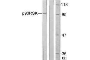 Western blot analysis of extract from HeLa cells, untreated or treated with PMA (200nM, 30min), using p90RSK (Ab-352) antibody (E021136). (RPS6KA3 antibody)