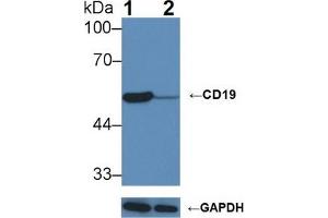 Knockout Varification: Lane 1: Wild-type Raji cell lysate; Lane 2: CD19 knockout Raji cell lysate; Predicted MW: 60kDa Observed MW: 54kDa Primary Ab: 1µg/ml Rabbit Anti-Mouse CD19 Antibody Second Ab: 0. (CD19 antibody  (AA 19-287))