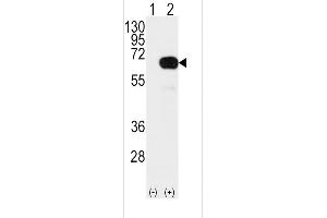 Western blot analysis of SMAD4 Antibody (T277) using rabbit polyclonal SMAD4 Antibody (T277) using 293 cell lysates (2 ug/lane) either nontransfected (Lane 1) or transiently transfected with the SMAD4 gene (Lane 2). (SMAD4 antibody  (AA 255-284))