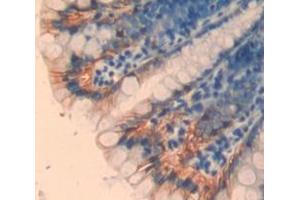 Used in DAB staining on fromalin fixed paraffin- embedded Kidney tissue (TPSB2 antibody  (AA 30-276))