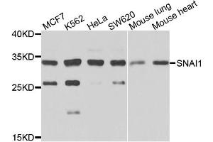 Western blot analysis of extracts of various cell lines, using SNAI1 antibody (ABIN5973228) at 1/1000 dilution. (SNAIL antibody)