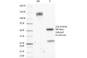 SDS-PAGE (SDS) image for anti-Estrogen Receptor 2 (ESR2) (C-Term) antibody (ABIN3024797)