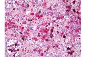 Anti-TFEB antibody IHC of human spleen. (TFEB antibody)