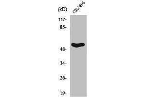 Western Blot analysis of COLO205 cells using Septin 1 Polyclonal Antibody (Septin 1 antibody  (Internal Region))