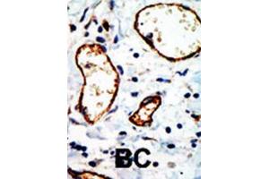 Immunohistochemistry (IHC) image for anti-Nuclear Receptor Co-Repressor 1 (NCOR1) antibody (ABIN2996086) (NCOR1 antibody)