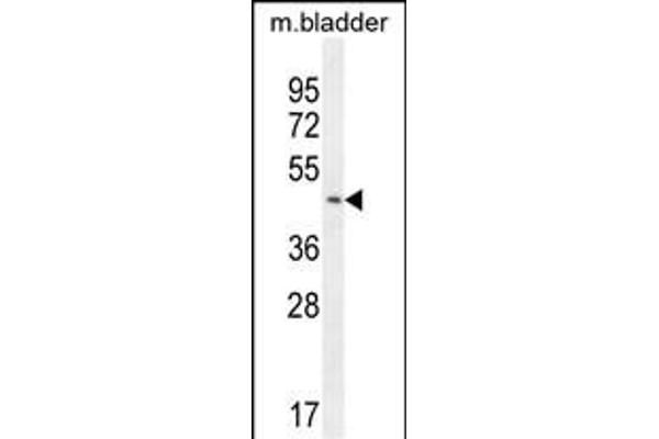 PARS2 antibody  (C-Term)