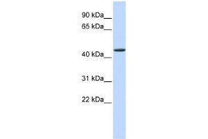 WB Suggested Anti-JMJD4 Antibody Titration:  0. (JMJD4 antibody  (N-Term))