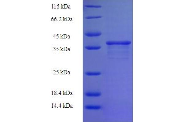 ZNF26 Protein (AA 335-533, partial) (His-SUMO Tag)