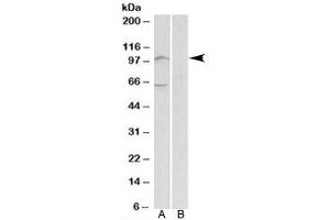 Western blot testing of human bone marrow lysate with UNC5B antibody at 2ug/ml with [B] and without [A] blocking/immunizing peptide. (UNC5B antibody)