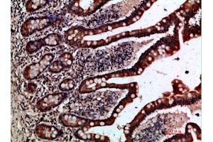 Immunohistochemical analysis of paraffin-embedded human-small-intestine, antibody was diluted at 1:200. (GREM2 antibody  (AA 71-120))