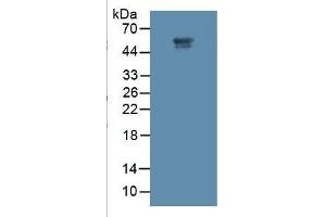 Western Blotting (WB) image for Matrix Metallopeptidase 11 (Stromelysin 3) (MMP11) ELISA Kit (ABIN6574149)