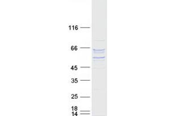 P4HA2 Protein (Transcript Variant 2) (Myc-DYKDDDDK Tag)