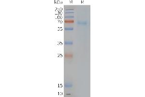 Human PT-Nanodisc, Flag Tag on SDS-PAGE (Prostaglandin D2 Receptor 2 (PTGDR2) Protein)