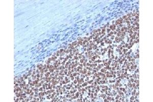 Immunohistochemistry (Formalin-fixed Paraffin-embedded Sections) (IHC (fp)) image for anti-Cyclin B1 (CCNB1) antibody (ABIN3025089)