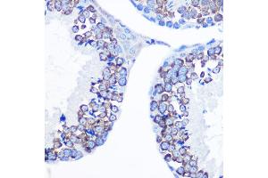 Immunohistochemistry of paraffin-embedded mouse testis using DDX4 Rabbit pAb (ABIN7266705) at dilution of 1:100 (40x lens). (DDX4 antibody  (AA 1-300))