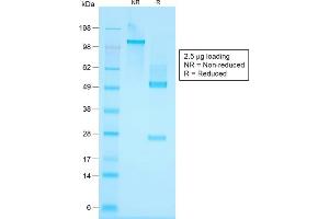 SDS-PAGE Analysis Purified Cytokeratin, HMW Rabbit Recombinant Monoclonal Antibody (KRTH/1576R). (Recombinant Cytokeratin 2 antibody)