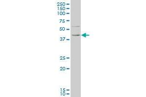 KLF1 monoclonal antibody (M05), clone 2A6 Western Blot analysis of KLF1 expression in K-562 (KLF1 antibody  (AA 183-237))