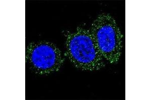 Confocal immunofluorescent analysis of anti-AKT2 antibody with HeLa cells followed by Alexa Fluor 488-conjugated goat anti-mouse lgG (green). (AKT2 antibody)