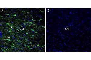 Expression of GPR52 in rat substantia nigra - Immunohistochemical staining of perfusion-fixed frozen rat brain sections with Anti-GPR52 Antibody (ABIN7043161, ABIN7044453 and ABIN7044454), (1:300), followed by goat anti-rabbit-AlexaFluor-488. (GPR52 antibody  (3rd Intracellular Loop))