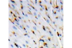 #VALUE! (SMAD2 antibody  (AA 274-467))