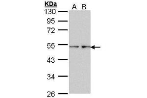 WB Image Sample (30 ug of whole cell lysate) A: HeLa B: Hep G2 , 7. (Fascin antibody  (Internal Region))