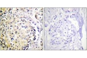 Immunohistochemistry (IHC) image for anti-Vimentin (VIM) (AA 31-80) antibody (ABIN2888938) (Vimentin antibody  (AA 31-80))