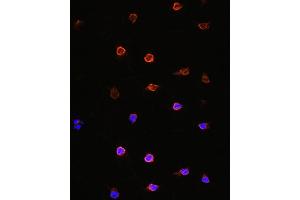 Immunofluorescence analysis of Y79 cells using  antibody (ABIN6129963, ABIN6136690, ABIN6136692 and ABIN6218362) at dilution of 1:100. (AIPL1 antibody  (AA 1-384))