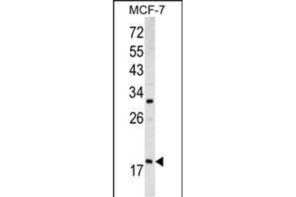 ARF3 antibody  (AA 78-106)