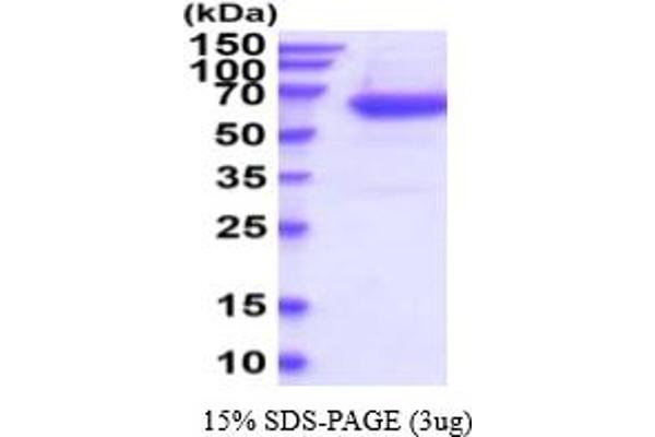 PLAT Protein (AA 311-562) (His tag)