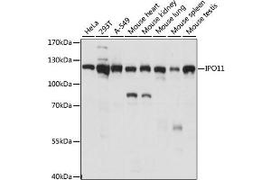 Western blot analysis of extracts of various cell lines, using IPO11 antibody (ABIN6290517) at 1:1000 dilution. (Importin 11 antibody)