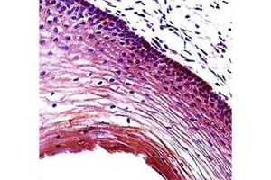 Puma antibody immunohistochemistry analysis in formalin fixed and paraffin embedded human cervix tissue. (PUMA antibody  (AA 109-137))