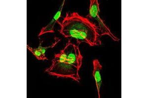 Immunofluorescence (IF) image for anti-Cyclin-Dependent Kinase 2 (CDK2) antibody (ABIN969506)