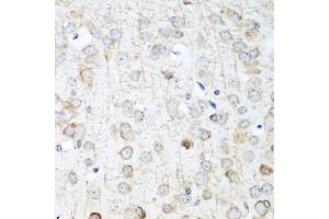 Immunohistochemistry of paraffin-embedded mouse brain using ANKRD52 antibody (ABIN5974842) at dilution of 1/100 (40x lens). (ANKRD52 antibody)