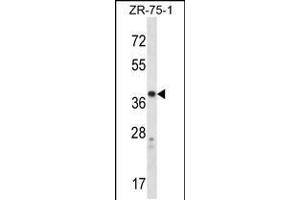 Western blot analysis in ZR-75-1 cell line lysates (35ug/lane). (CysLTR1 antibody  (AA 144-172))