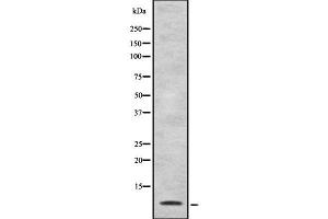 Western blot analysis of Defensin alpha4 using HuvEc whole cell lysates (DEFA4 antibody)