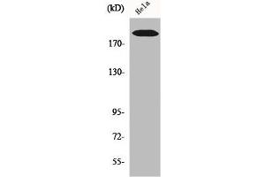 Western Blot analysis of Hela cells using COL5A1 Polyclonal Antibody (COL5A1 antibody  (Internal Region))