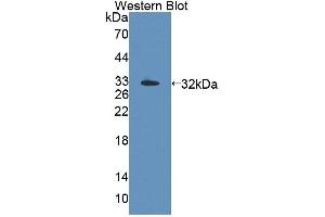 Western blot analysis of the recombinant protein. (TOP3B antibody  (AA 1-250))