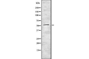 Western blot analysis of TXNRD1 using Jurkat whole cell lysates (TXNRD1 antibody  (Internal Region))