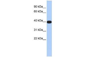 WB Suggested Anti-LMX1A Antibody Titration:  0. (LMX1A antibody  (N-Term))