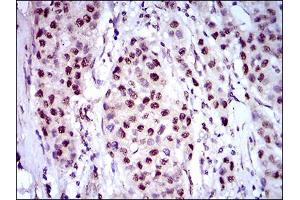 Immunohistochemistry (IHC) image for anti-Napsin A Aspartic Peptidase (NAPSA) (AA 20-158) antibody (ABIN1724854)