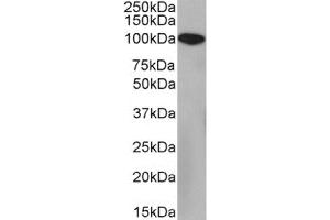 Western Blot using anti-CD10 antibody FR4D11. (Recombinant MME antibody)